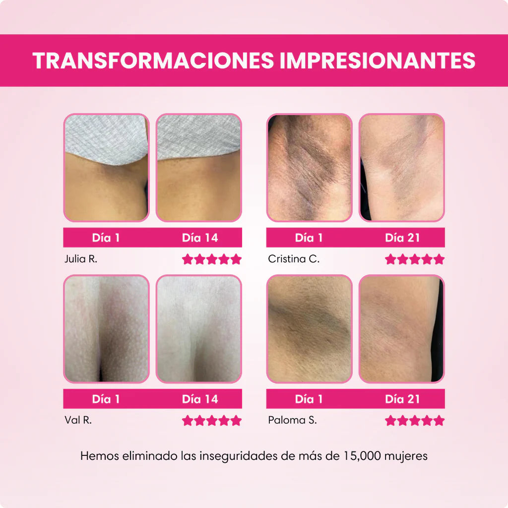 SKINGLOW ™ - Crema Aclarante