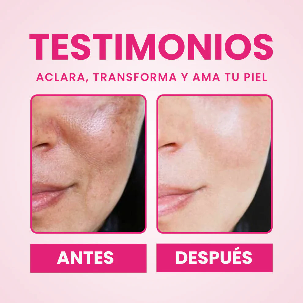 SKINGLOW ™ - Crema Aclarante