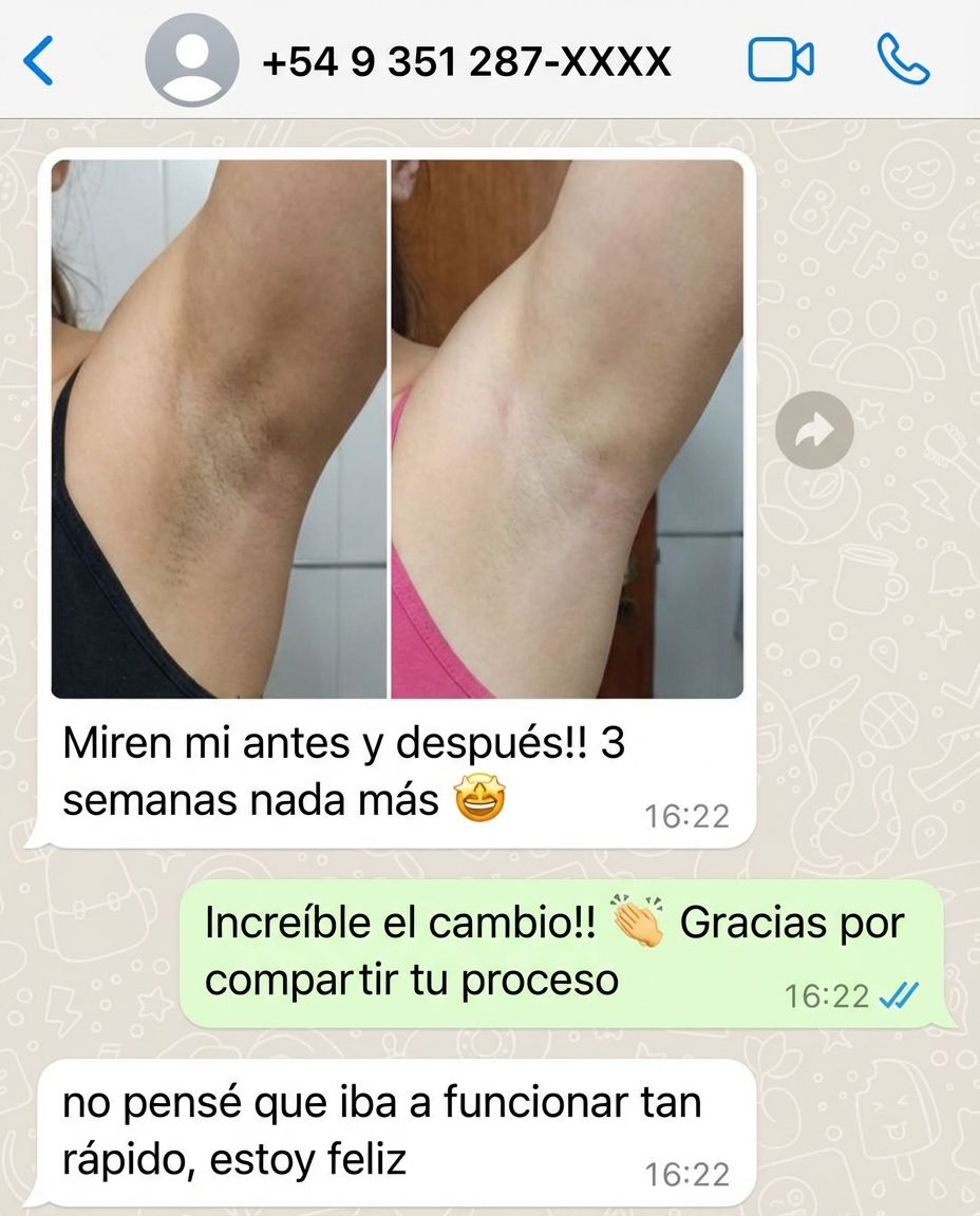 WhatsApp - antes/después axilas